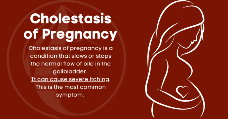 Cholestasis of pregnancy is a condition that slows or stops the normal flow of bile in the gallbladder. It can cause severe itching. This is the most common symptom.