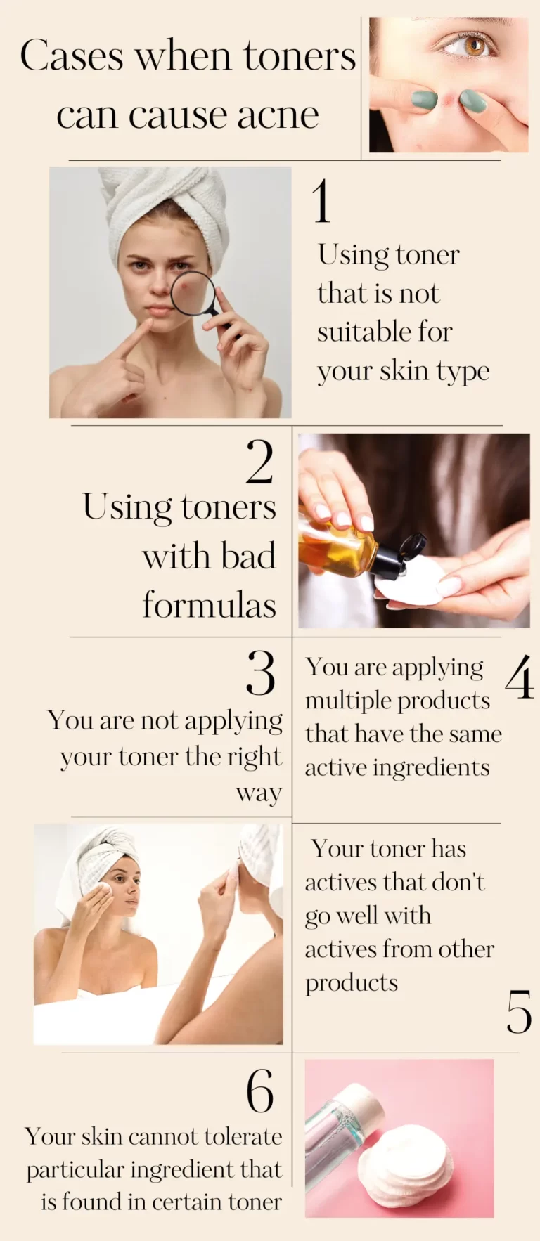 Cases when toners can cause acne