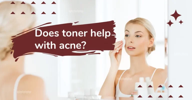 Does toner help with acne