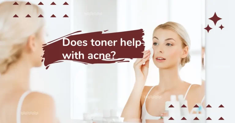 Does toner help with acne