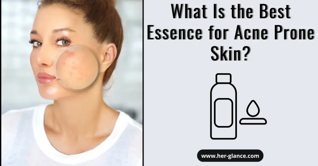 best essence for acne prone skin